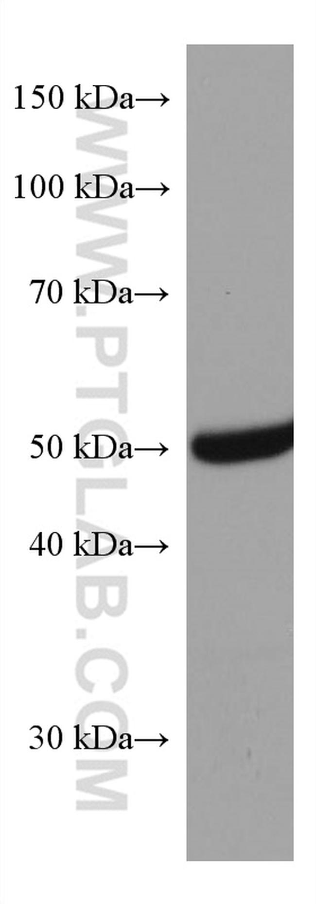 GSS Antibody in Western Blot (WB)