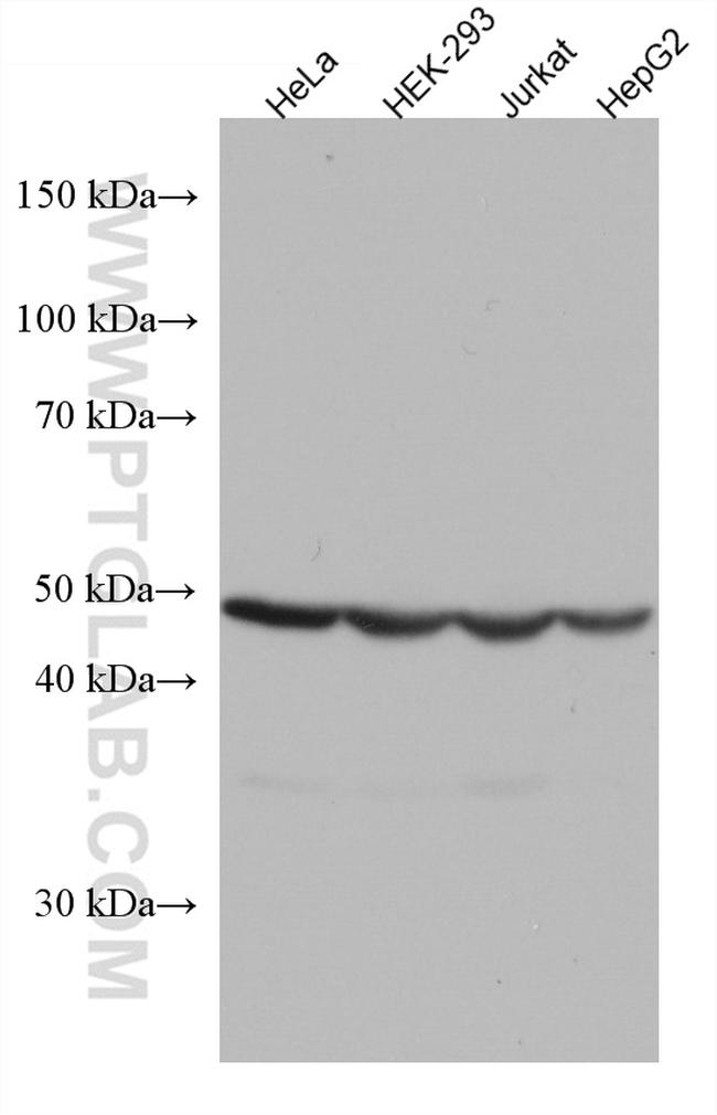 GSS Antibody in Western Blot (WB)