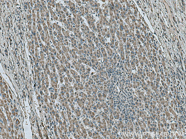 SDHB Antibody in Immunohistochemistry (Paraffin) (IHC (P))