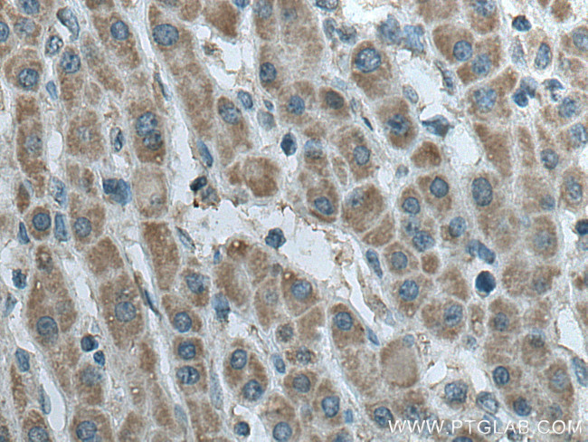 SDHB Antibody in Immunohistochemistry (Paraffin) (IHC (P))