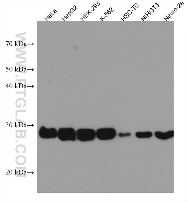 SDHB Antibody in Western Blot (WB)