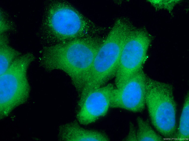 EIF1 Antibody in Immunocytochemistry (ICC/IF)