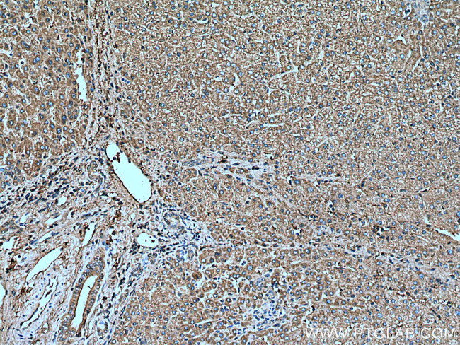 SERPIND1 Antibody in Immunohistochemistry (Paraffin) (IHC (P))