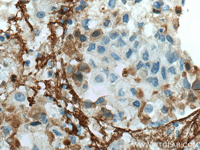 Collagen Type V Antibody in Immunohistochemistry (Paraffin) (IHC (P))