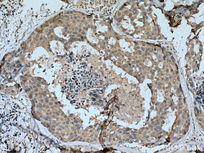 SCLY Antibody in Immunohistochemistry (Paraffin) (IHC (P))