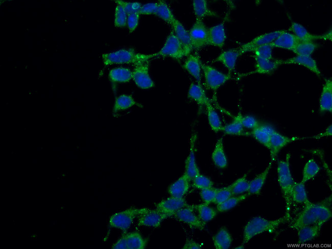 VPS53 Antibody in Immunocytochemistry (ICC/IF)