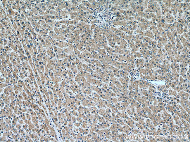 VPS53 Antibody in Immunohistochemistry (Paraffin) (IHC (P))