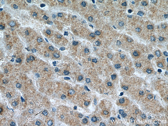 VPS53 Antibody in Immunohistochemistry (Paraffin) (IHC (P))