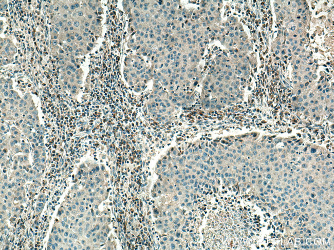 PSAT1 Antibody in Immunohistochemistry (Paraffin) (IHC (P))