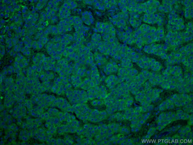 WASF3 Antibody in Immunohistochemistry (Paraffin) (IHC (P))