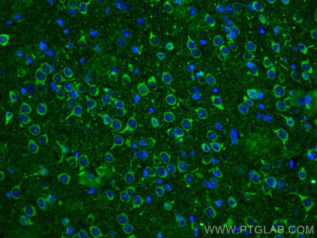 WASF3 Antibody in Immunohistochemistry (PFA fixed) (IHC (PFA))