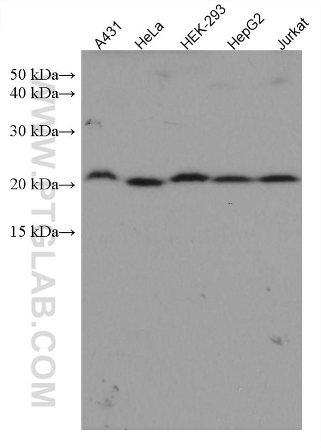 TAF12 Antibody in Western Blot (WB)