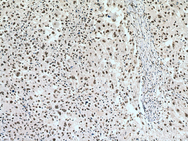 PSME3 Antibody in Immunohistochemistry (Paraffin) (IHC (P))