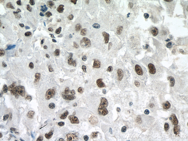 PSME3 Antibody in Immunohistochemistry (Paraffin) (IHC (P))