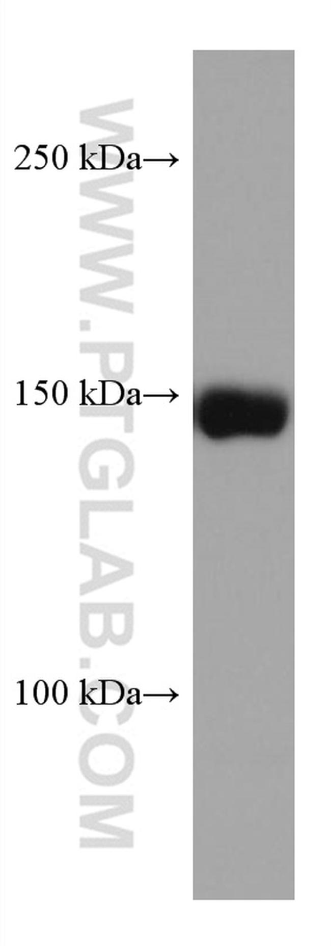 CPS1 Antibody in Western Blot (WB)