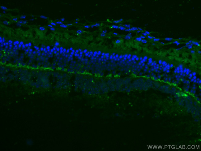 ANO2 Antibody in Immunohistochemistry (Paraffin) (IHC (P))