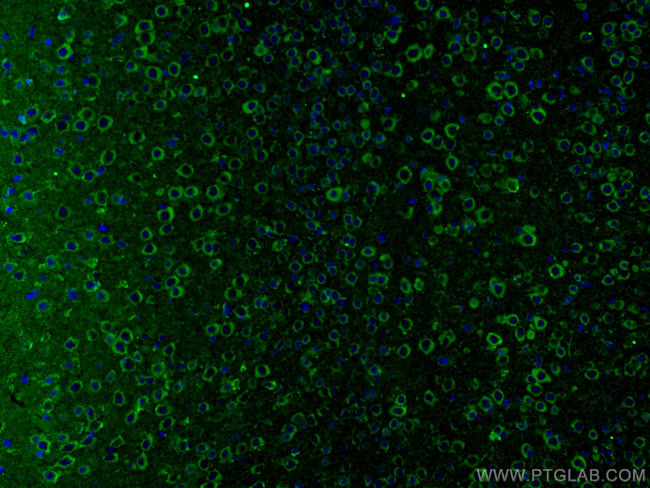 GRIA1 Antibody in Immunohistochemistry (Paraffin) (IHC (P))