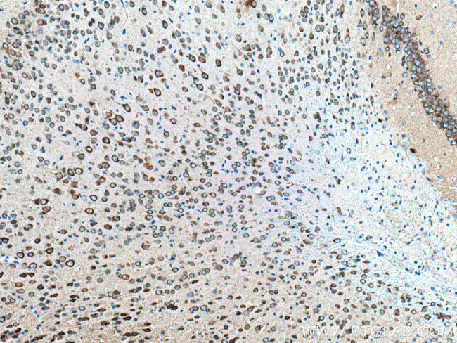 GRIA1 Antibody in Immunohistochemistry (Paraffin) (IHC (P))