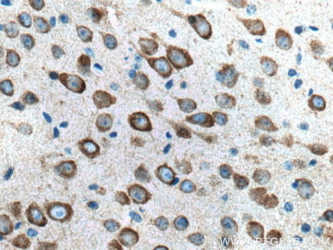 GRIA1 Antibody in Immunohistochemistry (Paraffin) (IHC (P))