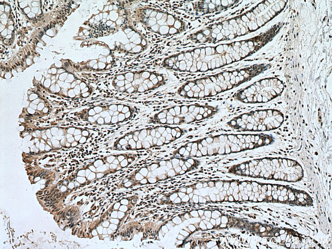 PI3 Kinase p85 Beta Antibody in Immunohistochemistry (Paraffin) (IHC (P))