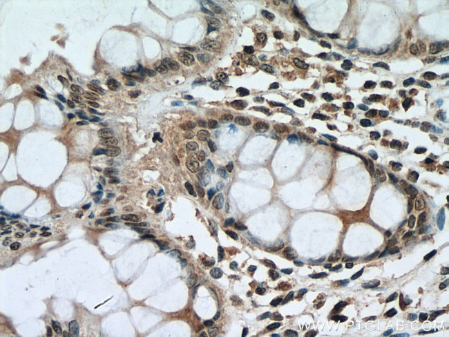 PI3 Kinase p85 Beta Antibody in Immunohistochemistry (Paraffin) (IHC (P))