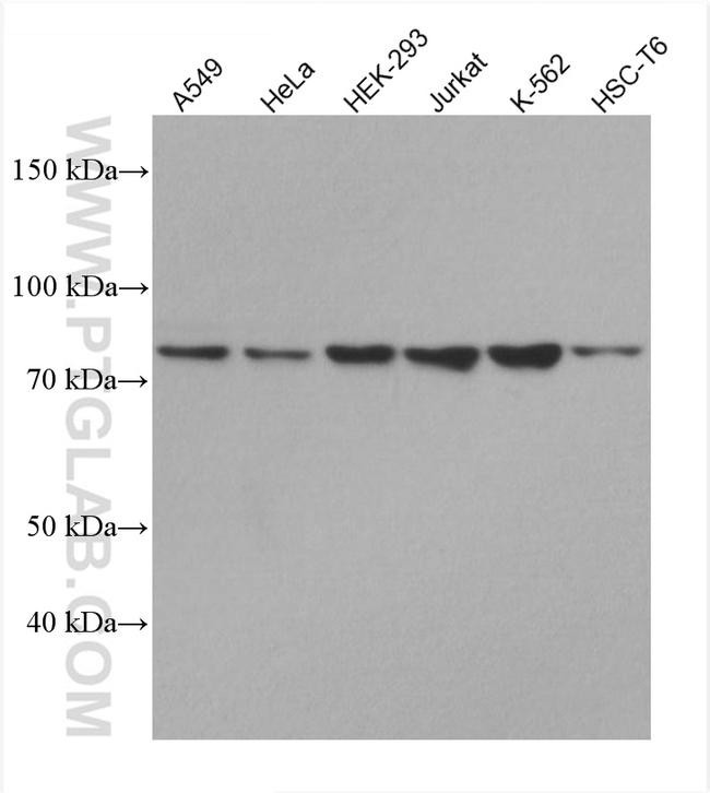 GNE Antibody in Western Blot (WB)