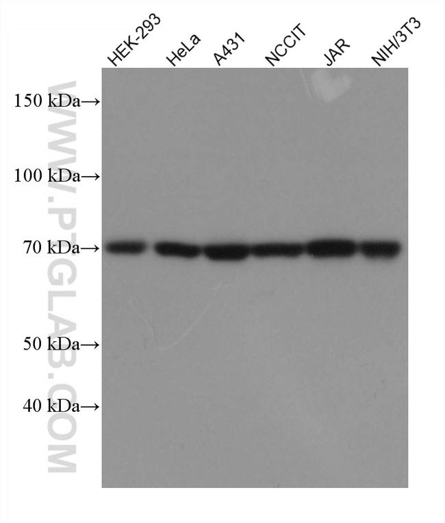 TCF7L1/TCF7L2 Antibody in Western Blot (WB)