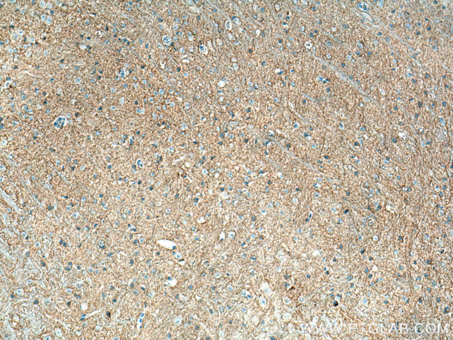 P2RY1 Antibody in Immunohistochemistry (Paraffin) (IHC (P))