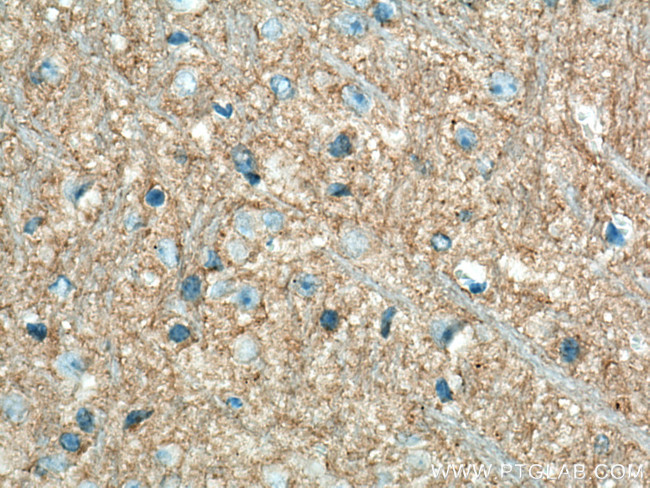 P2RY1 Antibody in Immunohistochemistry (Paraffin) (IHC (P))