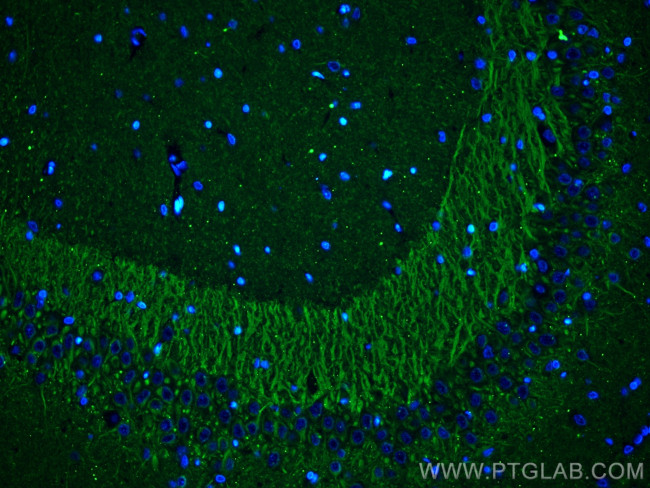 P2RY1 Antibody in Immunohistochemistry (PFA fixed) (IHC (PFA))