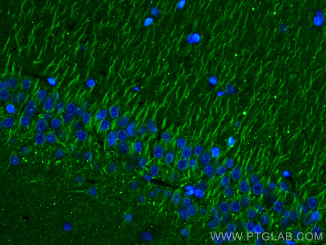 P2RY1 Antibody in Immunohistochemistry (PFA fixed) (IHC (PFA))