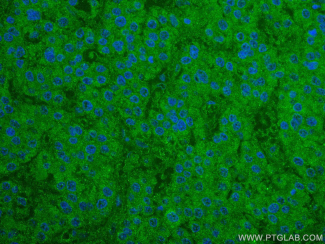 NCAPH Antibody in Immunohistochemistry (Paraffin) (IHC (P))