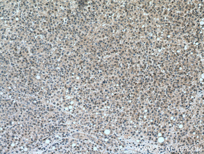 NCAPH Antibody in Immunohistochemistry (Paraffin) (IHC (P))