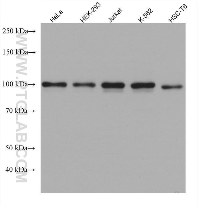 NCAPH Antibody in Western Blot (WB)