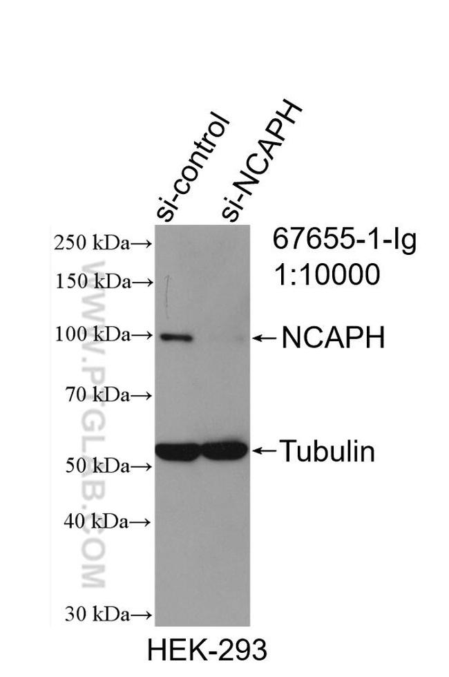 NCAPH Antibody in Western Blot (WB)