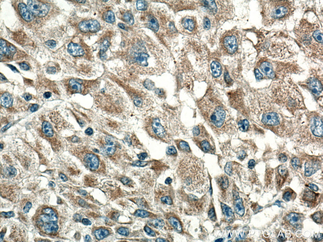 CYR61 Antibody in Immunohistochemistry (Paraffin) (IHC (P))