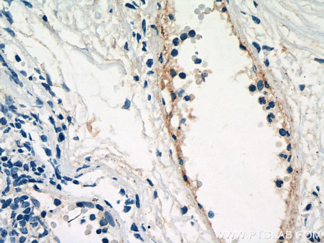 PROCR Antibody in Immunohistochemistry (Paraffin) (IHC (P))