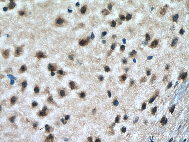 RAB18 Antibody in Immunohistochemistry (Paraffin) (IHC (P))