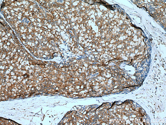 IMPDH2 Antibody in Immunohistochemistry (Paraffin) (IHC (P))