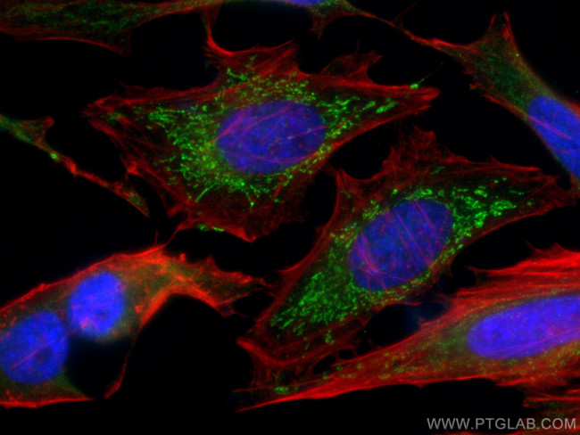 SNX5 Antibody in Immunocytochemistry (ICC/IF)