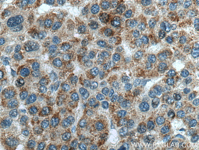 SNX5 Antibody in Immunohistochemistry (Paraffin) (IHC (P))