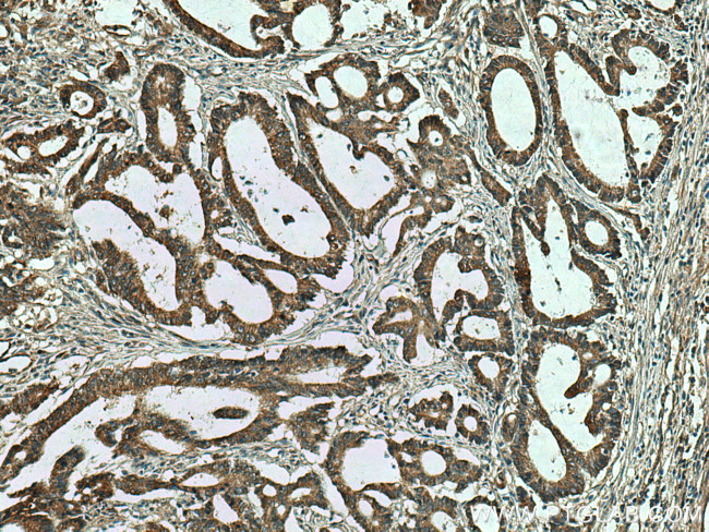 MTHFD1 Antibody in Immunohistochemistry (Paraffin) (IHC (P))