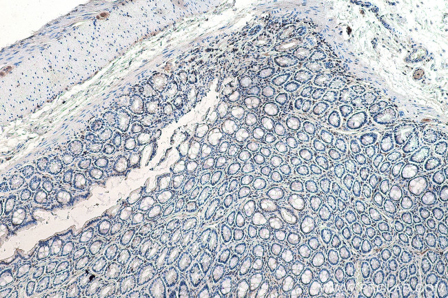 DVL1 Antibody in Immunohistochemistry (Paraffin) (IHC (P))