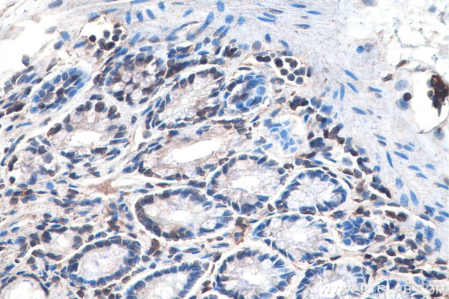 DVL1 Antibody in Immunohistochemistry (Paraffin) (IHC (P))