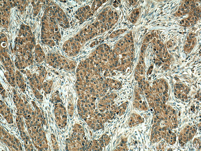 EIF2AK1 Antibody in Immunohistochemistry (Paraffin) (IHC (P))