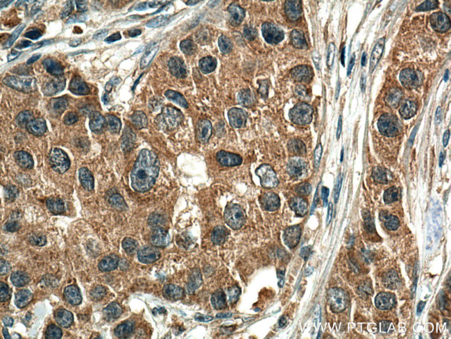 EIF2AK1 Antibody in Immunohistochemistry (Paraffin) (IHC (P))