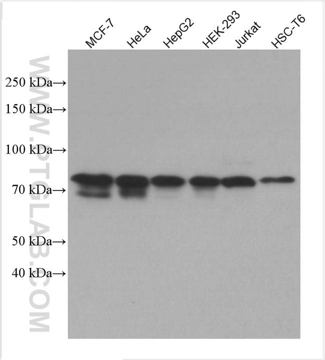 EIF2AK1 Antibody in Western Blot (WB)