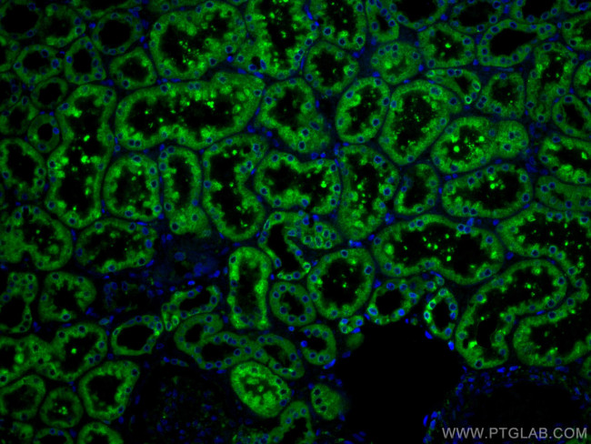 ERP29 Antibody in Immunohistochemistry (Paraffin) (IHC (P))