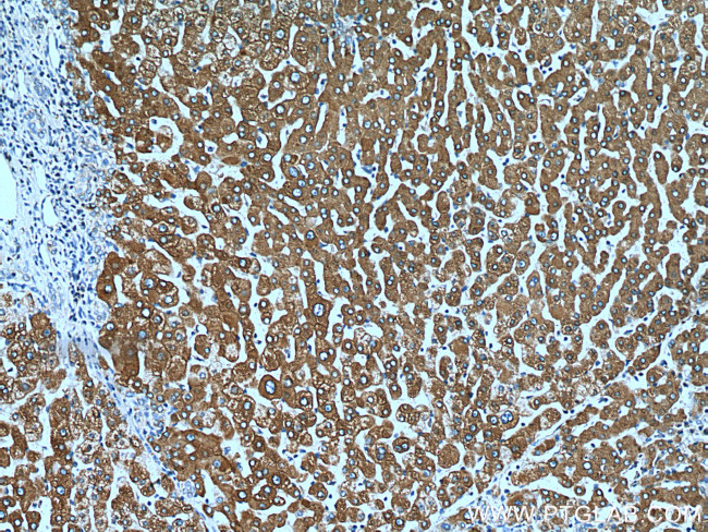 ERP29 Antibody in Immunohistochemistry (Paraffin) (IHC (P))