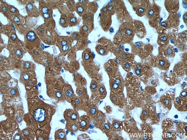 ERP29 Antibody in Immunohistochemistry (Paraffin) (IHC (P))